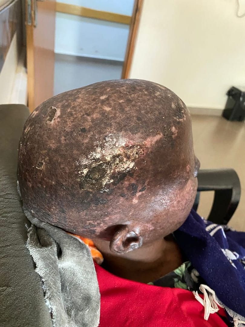 [#content_spinnerchief] 